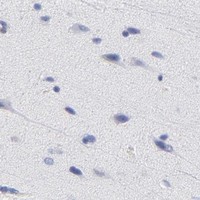 HPA IHC Cerebral cortex — ZAP70