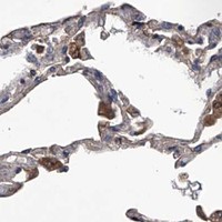 HPA IHC Lung — ABCG1