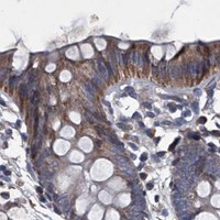 HPA IHC Colon — ABCG1