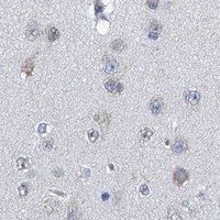 HPA IHC Cerebral cortex — ABCG1