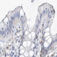 HPA IHC Colon — REEP2