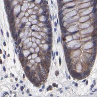 HPA IHC Colon — CCT2