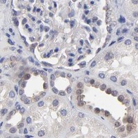 HPA IHC Kidney — CCT2