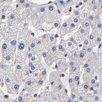 HPA IHC Liver — CCT2