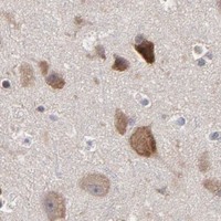 HPA IHC Cerebral cortex — CCT2