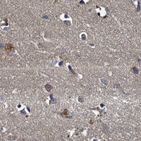 HPA IHC Cerebral cortex — SLC11A2