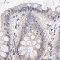 HPA IHC Colon — PTK7