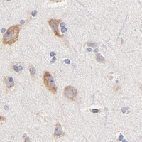 HPA IHC Cerebral cortex — PTK7