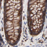 HPA IHC Colon — CD2AP