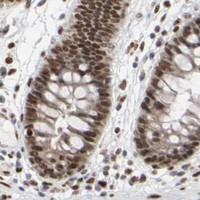HPA IHC Colon — CUX1