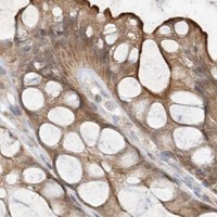 HPA IHC Colon — BTRC