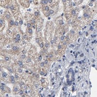 HPA IHC Liver — TXNRD2