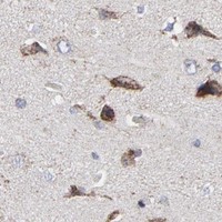 HPA IHC Cerebral cortex — TXNRD2