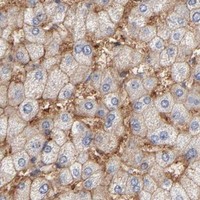 HPA IHC Liver — SLC16A1