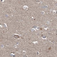 HPA IHC Cerebral cortex — ADAM23