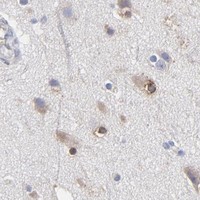 HPA IHC Cerebral cortex — MOSPD2