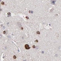 HPA IHC Cerebral cortex — SMARCA1