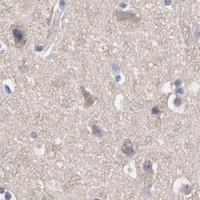HPA IHC Cerebral cortex — DUSP9
