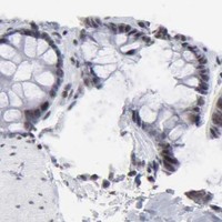 HPA IHC Colon — SP2