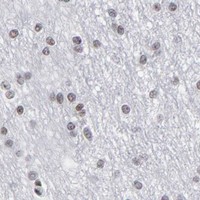 HPA IHC Cerebral cortex — SP2