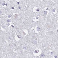 HPA IHC Cerebral cortex — CHAF1B