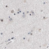 HPA IHC Cerebral cortex — TFDP1