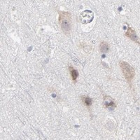 HPA IHC Cerebral cortex — RPS24