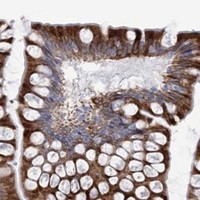 HPA IHC Small intestine — CYP3A4