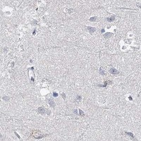 HPA IHC Cerebral cortex — CYP3A4