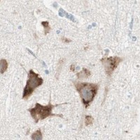 HPA IHC Cerebral cortex — RPL23