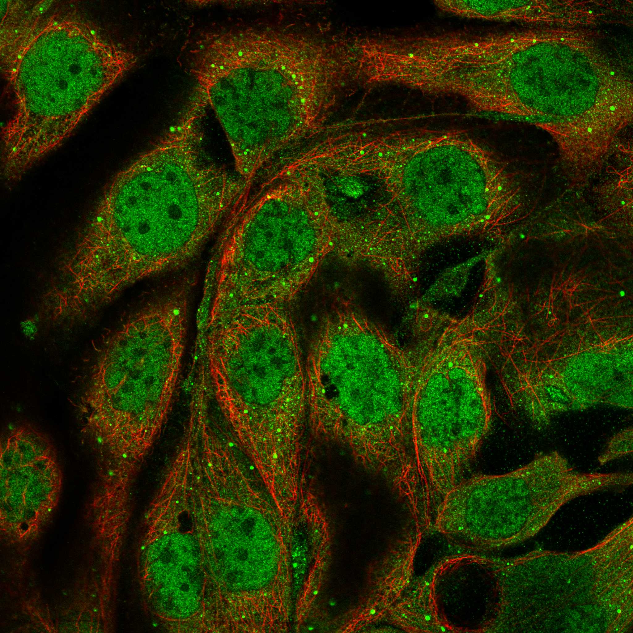 Subcellular TMSB4X The Human Protein Atlas