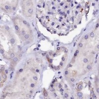 HPA IHC Kidney — RAB27A