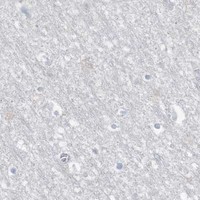 HPA IHC Cerebral cortex — PAX6