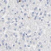 HPA IHC Liver — GZMB