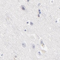 HPA IHC Cerebral cortex — ITGA8