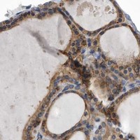 HPA IHC Thyroid gland — ATG5