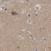 HPA IHC Cerebral cortex — ATG5