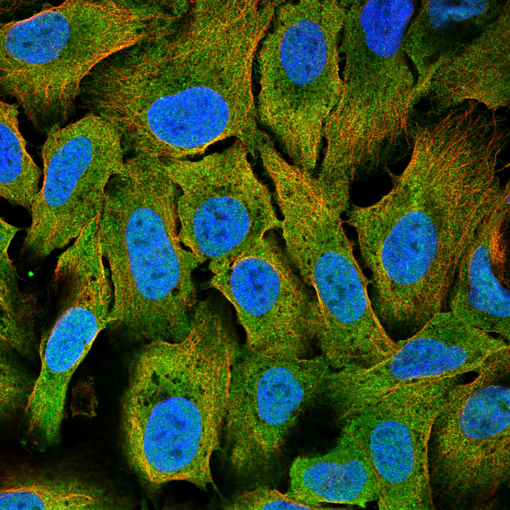 Subcellular ITPRID2 The Human Protein Atlas