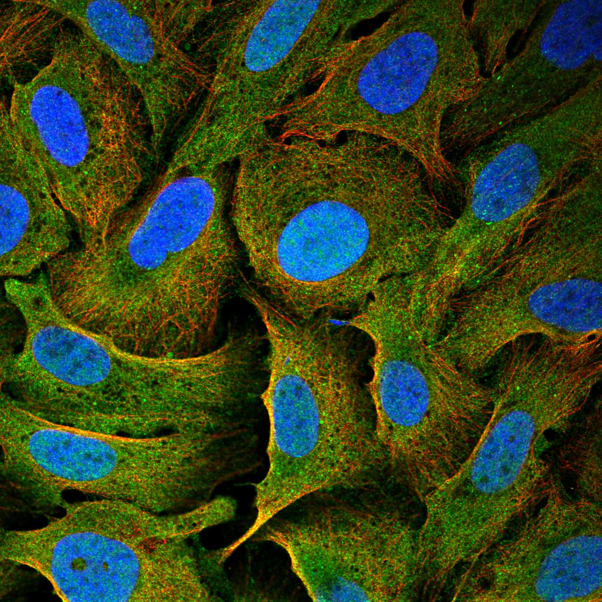 Subcellular ITPRID2 The Human Protein Atlas