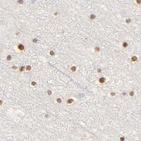 HPA IHC Cerebral cortex — NKX2-2