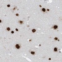 HPA IHC Cerebral cortex — KHSRP