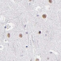 HPA IHC Cerebral cortex — SNRPN