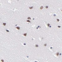 HPA IHC Caudate — SNRPN