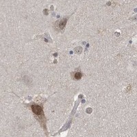 HPA IHC Cerebral cortex — TAB3