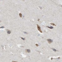 HPA IHC Cerebral cortex — ABCB7
