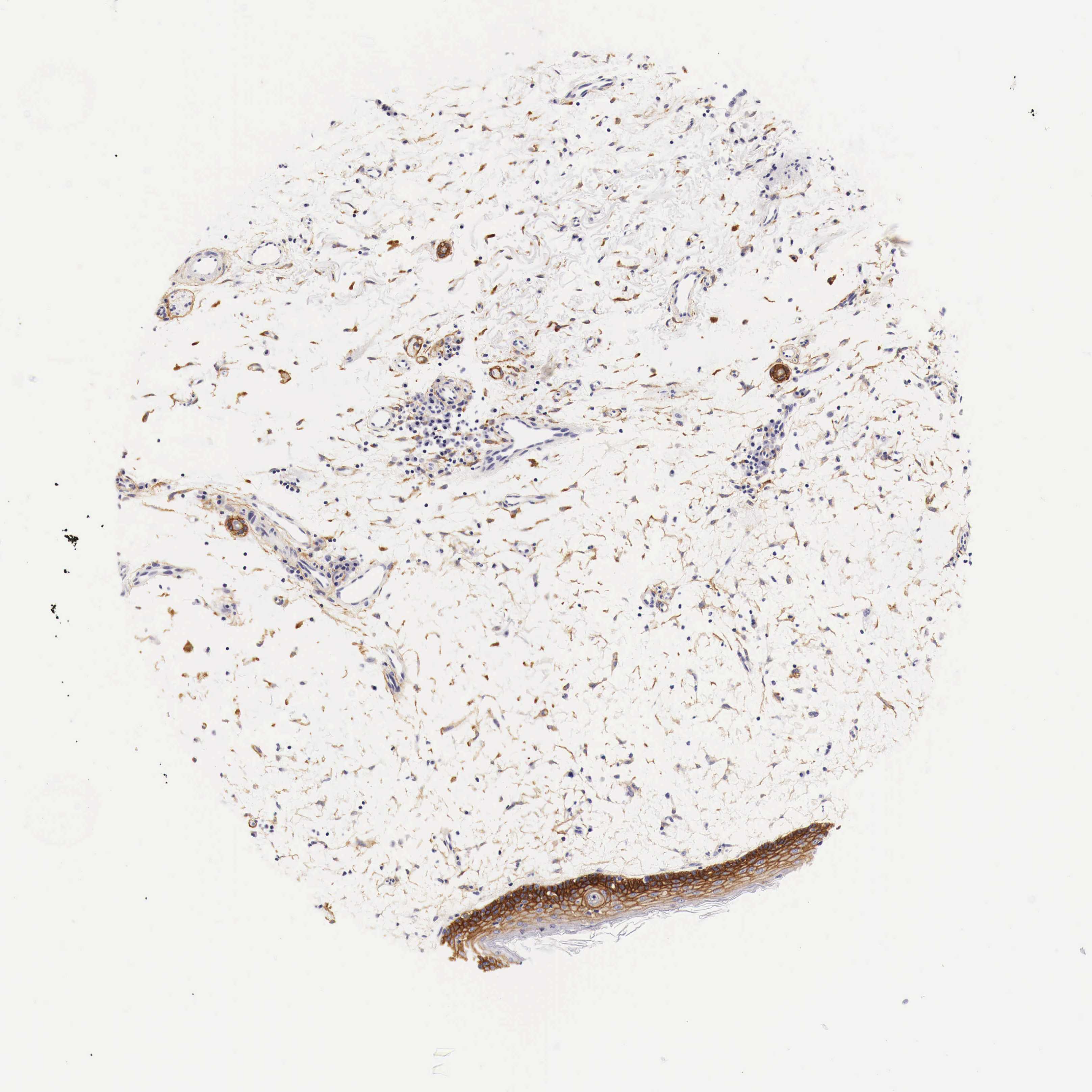 Tissue expression of EGFR Staining in skin The Human Protein Atlas