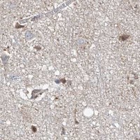 HPA IHC Cerebral cortex — CHPF