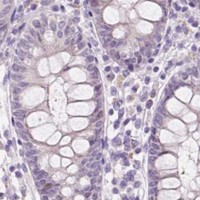 HPA IHC Colon — DPPA4