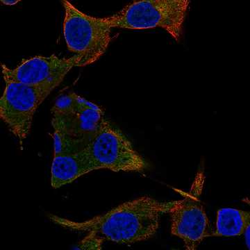 HPA035293: SK-MEL-30