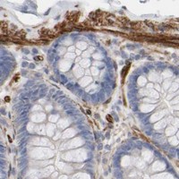HPA IHC Colon — GNG2